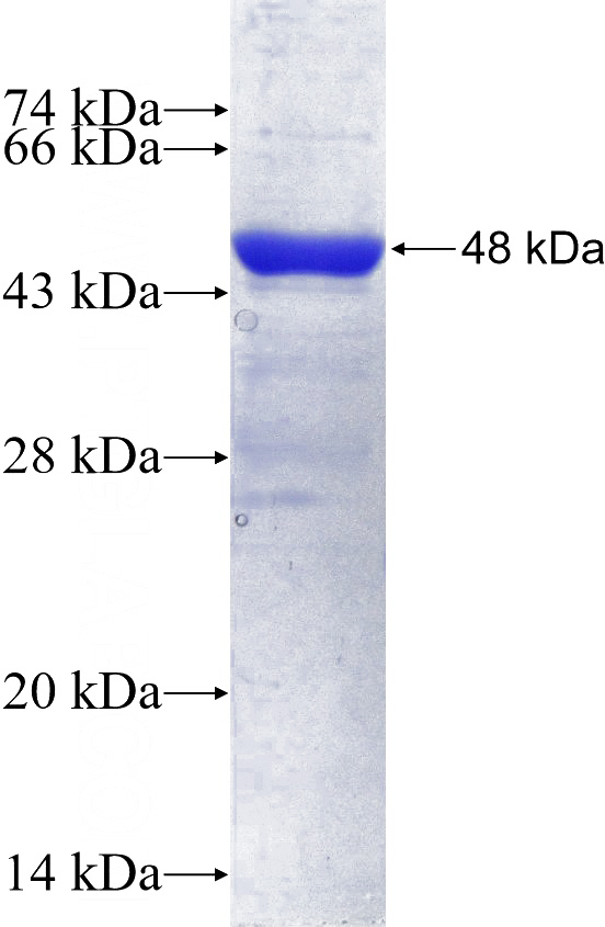 Recombinant Human ERP29 SDS-PAGE
