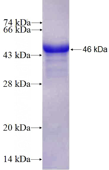 Recombinant Human C19orf62 SDS-PAGE