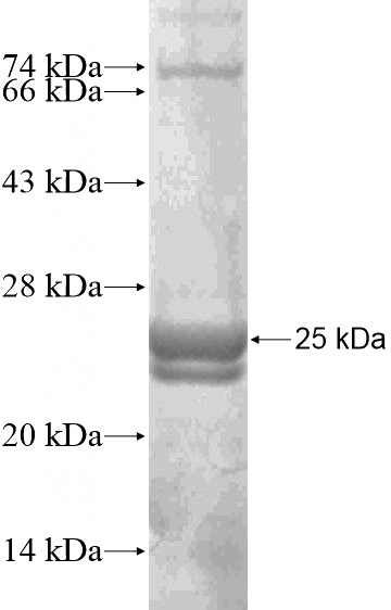Recombinant Human IRGM SDS-PAGE