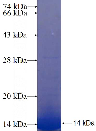 Recombinant Human FAM9B SDS-PAGE