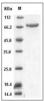 Human TGM3 / Transglutaminase 3 Protein (His Tag) SDS-PAGE