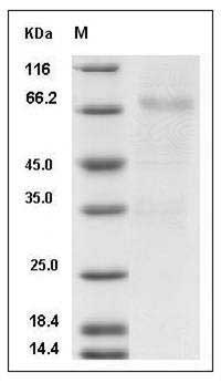 Mouse GFRA3 / GFR-alpha-3 Protein (Fc Tag) SDS-PAGE