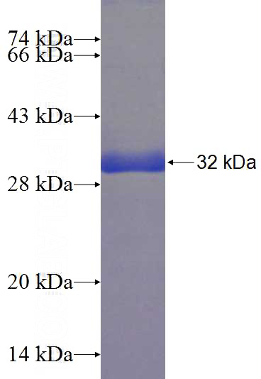 Recombinant Human A1CF SDS-PAGE