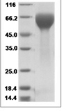 Rhesus IL17RA recombinant protein (C-His)