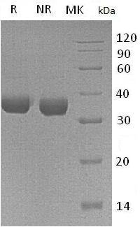 Human TPSAB1/TPS1/TPS2/TPSB1 (His tag) recombinant protein