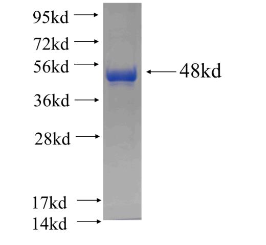 Recombinant human SPOP SDS-PAGE