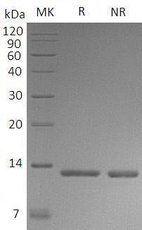 Human S100A4/CAPL/MTS1 (His tag) recombinant protein
