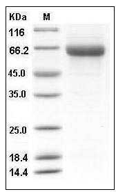 Influenza A H6N1 (A/northern shoveler/California/HKWF115/2007) Hemagglutinin / HA Protein (His Tag) SDS-PAGE