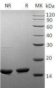 Human OCM/OCM1/OCMN (His tag) recombinant protein