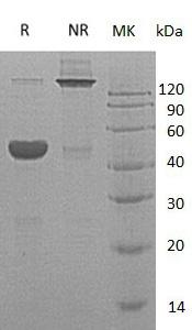 Human GABARAP/hCG_1987397 (His tag) recombinant protein