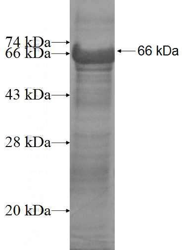 Recombinant Human PPP2R3A SDS-PAGE