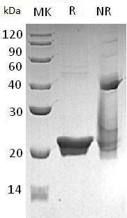 Human LCN2/HNL/NGAL (His tag) recombinant protein