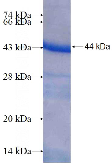 Recombinant Human HACL1 SDS-PAGE