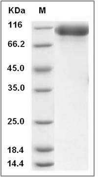 Rat HER3 / ErbB3 Protein (His Tag) SDS-PAGE