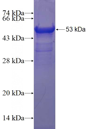 Recombinant Human VWA1 SDS-PAGE