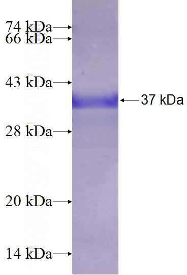 Recombinant Human DIO2 SDS-PAGE