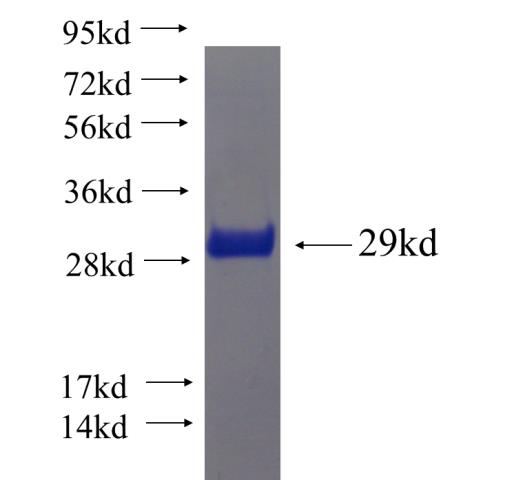 Recombinant human CCM2 SDS-PAGE