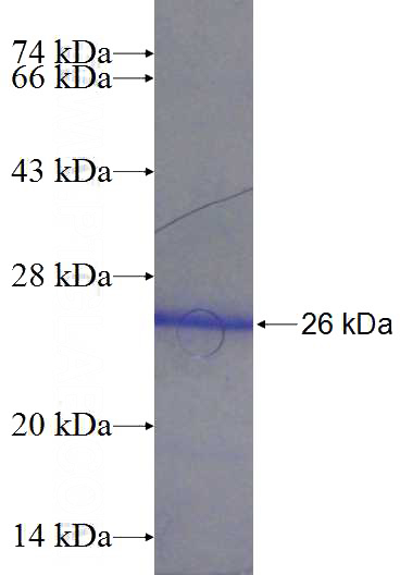 Recombinant Human COMMD3 SDS-PAGE