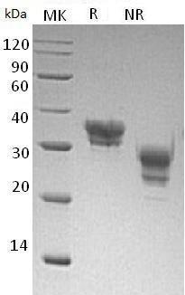 Human CLMP/ACAM/ASAM/UNQ318/PRO363 (His tag) recombinant protein
