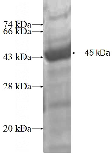 Recombinant Human CHST12 SDS-PAGE