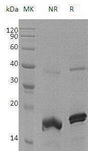 Human PTP4A2/PRL2/PTPCAAX2/BM-008 (His tag) recombinant protein