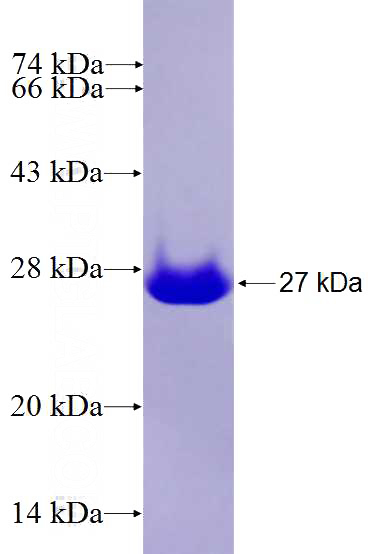 Human CDH5 Recombinant protein (6*His tag)