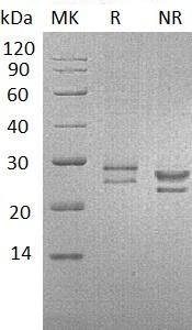 Human CRISP3 (His tag) recombinant protein