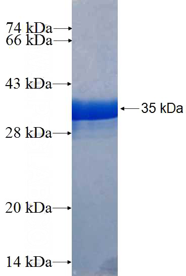 Recombinant Human IER5 SDS-PAGE