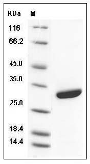 Human Adipsin / Complement Factor D / CFD Protein (His Tag) SDS-PAGE