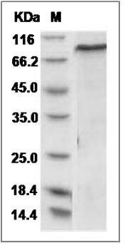 Mouse Smad2 Protein (His & GST Tag) SDS-PAGE