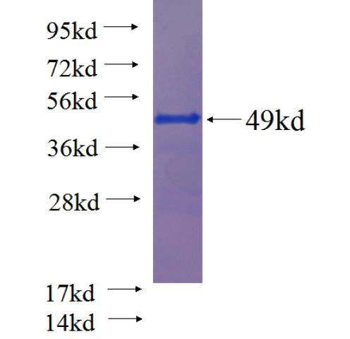 Recombinant human PPP1R2 SDS-PAGE