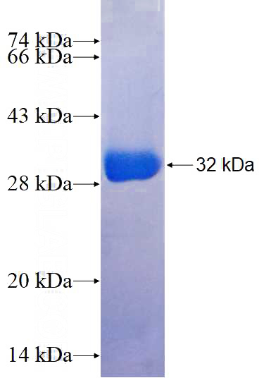 Recombinant Human PRUNE2 SDS-PAGE