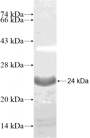 Recombinant Human HORMAD2 SDS-PAGE