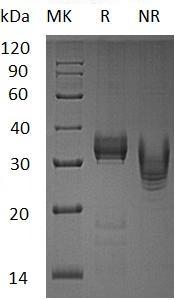 Human KLK13/KLKL4 (His tag) recombinant protein