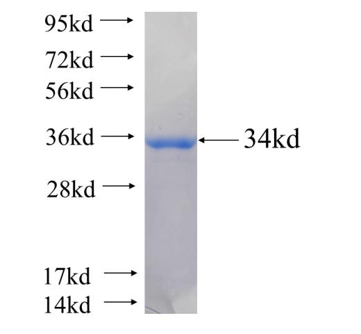 Recombinant human ATP6V1D(Full length) SDS-PAGE
