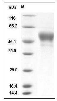Influenza A H4N4 (A/mallard duck/Alberta/299/1977) Hemagglutinin Protein (HA1 Subunit) (His Tag) SDS-PAGE