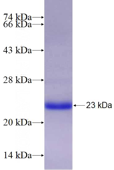 Recombinant Human COMMD5 SDS-PAGE