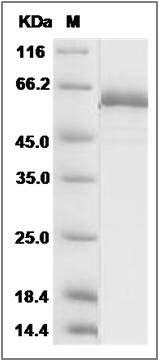 Rat TLR2 Protein (His Tag) SDS-PAGE