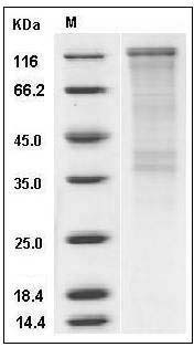 Human CDON / CDO Protein (His Tag) SDS-PAGE