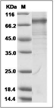 Cynomolgus CDH18 / Cadherin-18 Protein (His Tag) SDS-PAGE