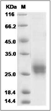 Rat CD90 / THY-1 Protein (His Tag) SDS-PAGE