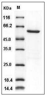 Human NEK7 Protein (His & GST Tag) SDS-PAGE