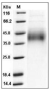 Mouse Growth Hormone Receptor / GHR / GHBP Protein (His Tag) SDS-PAGE