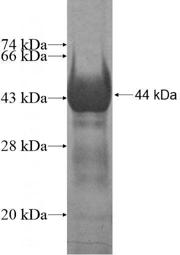 Recombinant Human OSBPL7 SDS-PAGE