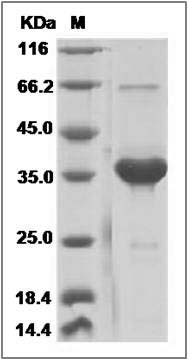 Human SMR3B Protein (Fc Tag) SDS-PAGE