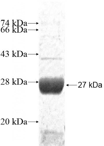 Recombinant Human GSTA4 SDS-PAGE
