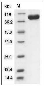 Human Tie1 Protein (His Tag) SDS-PAGE