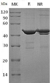 Human RHEB/RHEB2 (GST tag) recombinant protein