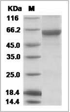 Influenza A H9N2 (A/Guinea fowl/Hong Kong/WF10/99) Hemagglutinin / HA Protein (His Tag)