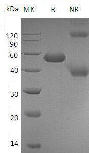 Mouse Cd5l/Aim/Api6 (His tag) recombinant protein